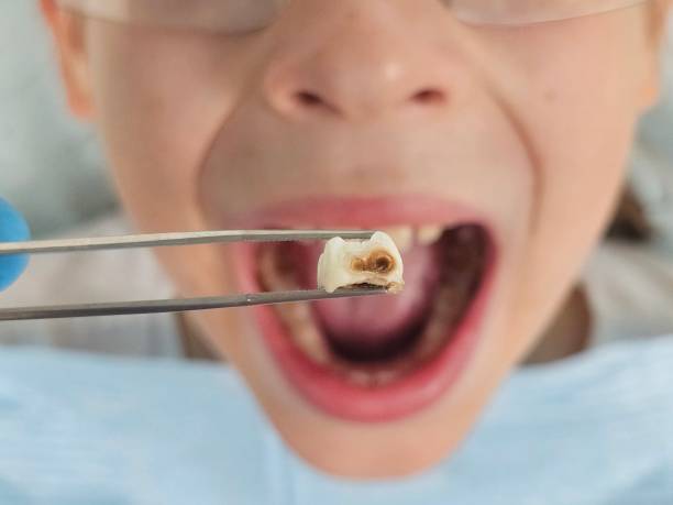 Best Emergency Tooth Extraction  in Prineville, OR